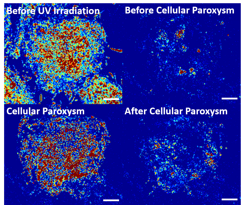 Cellular paroxysm image